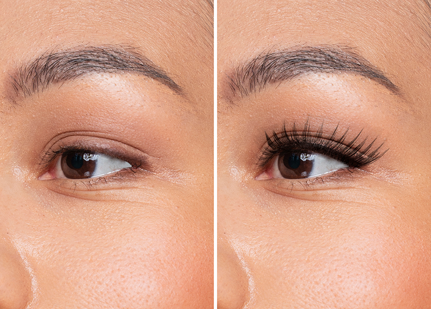 careprost eyelash growth